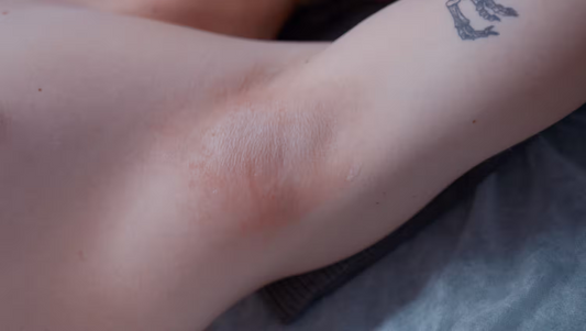 Irritated Skin After Waxing: How to Assess, Soothe, and Prevent Reactions Like a Pro